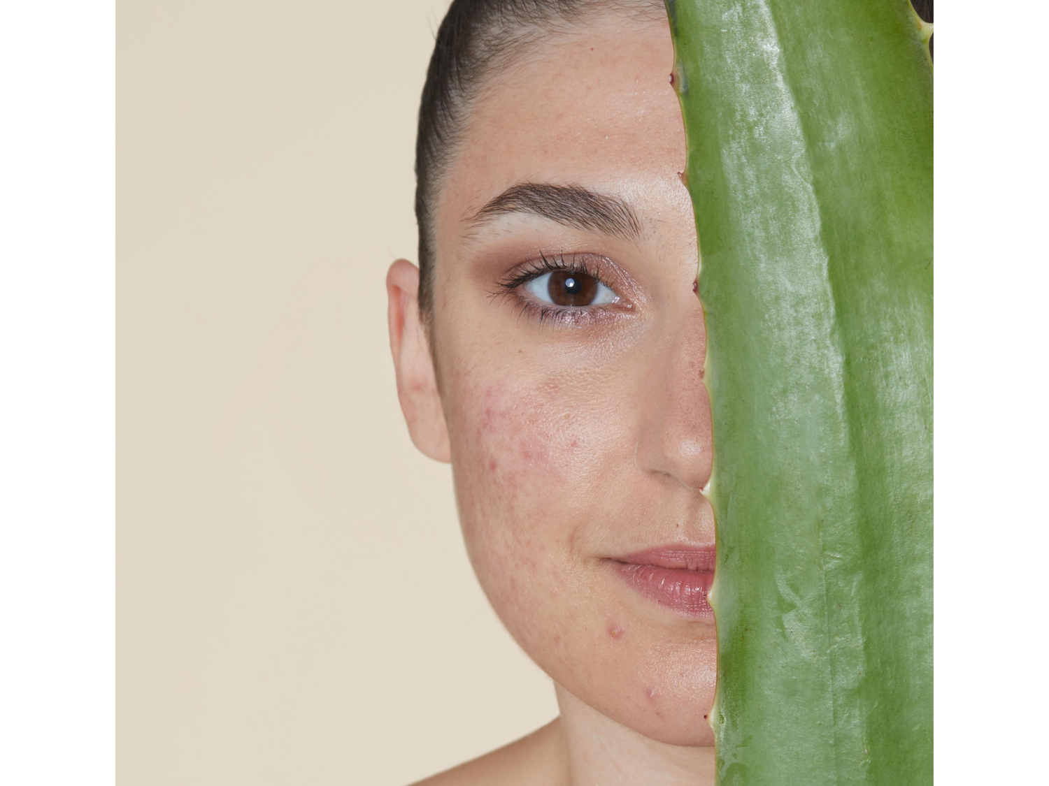 L'acné du cycle - Skin & Out