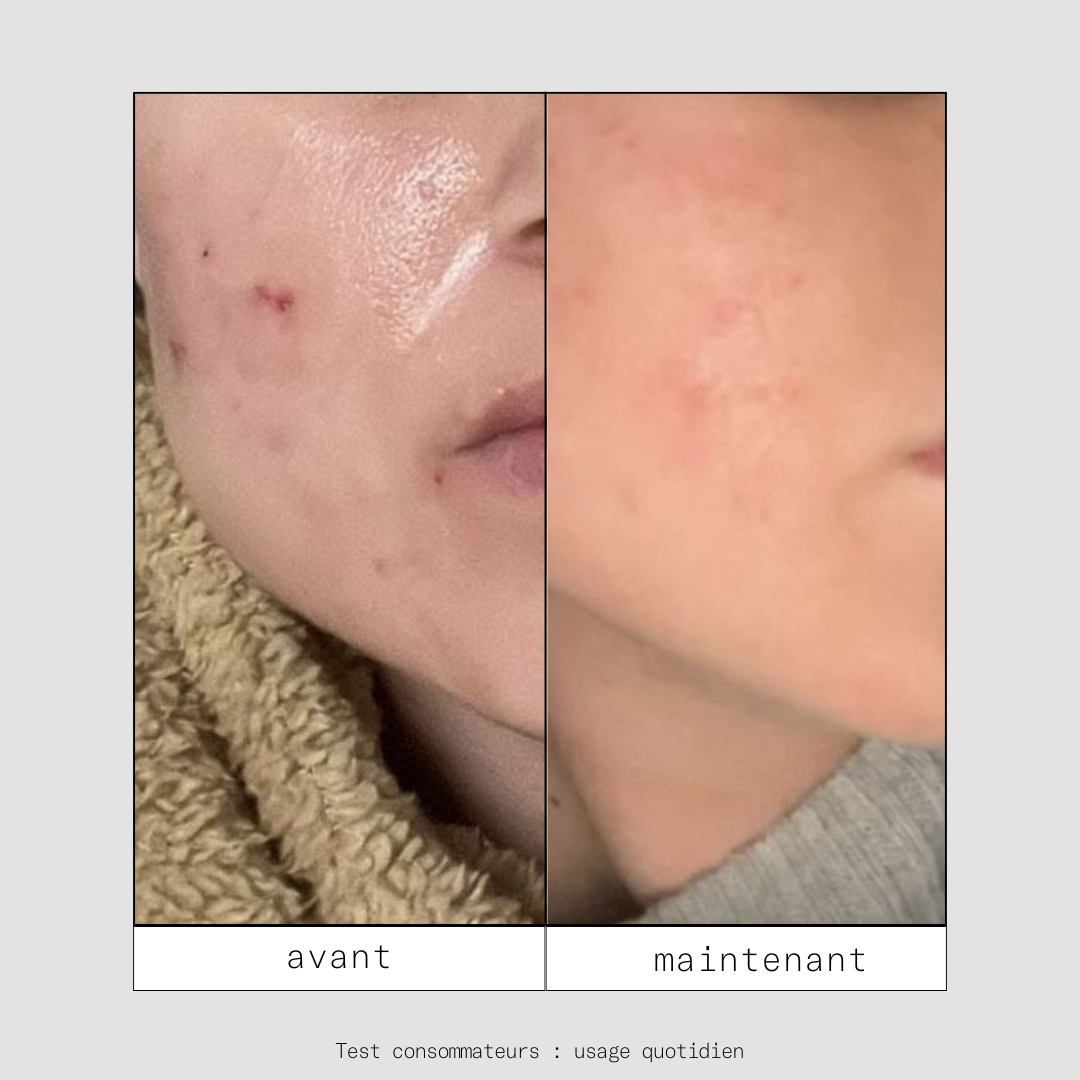 Minis Shtars - mini routine spéciale boutons