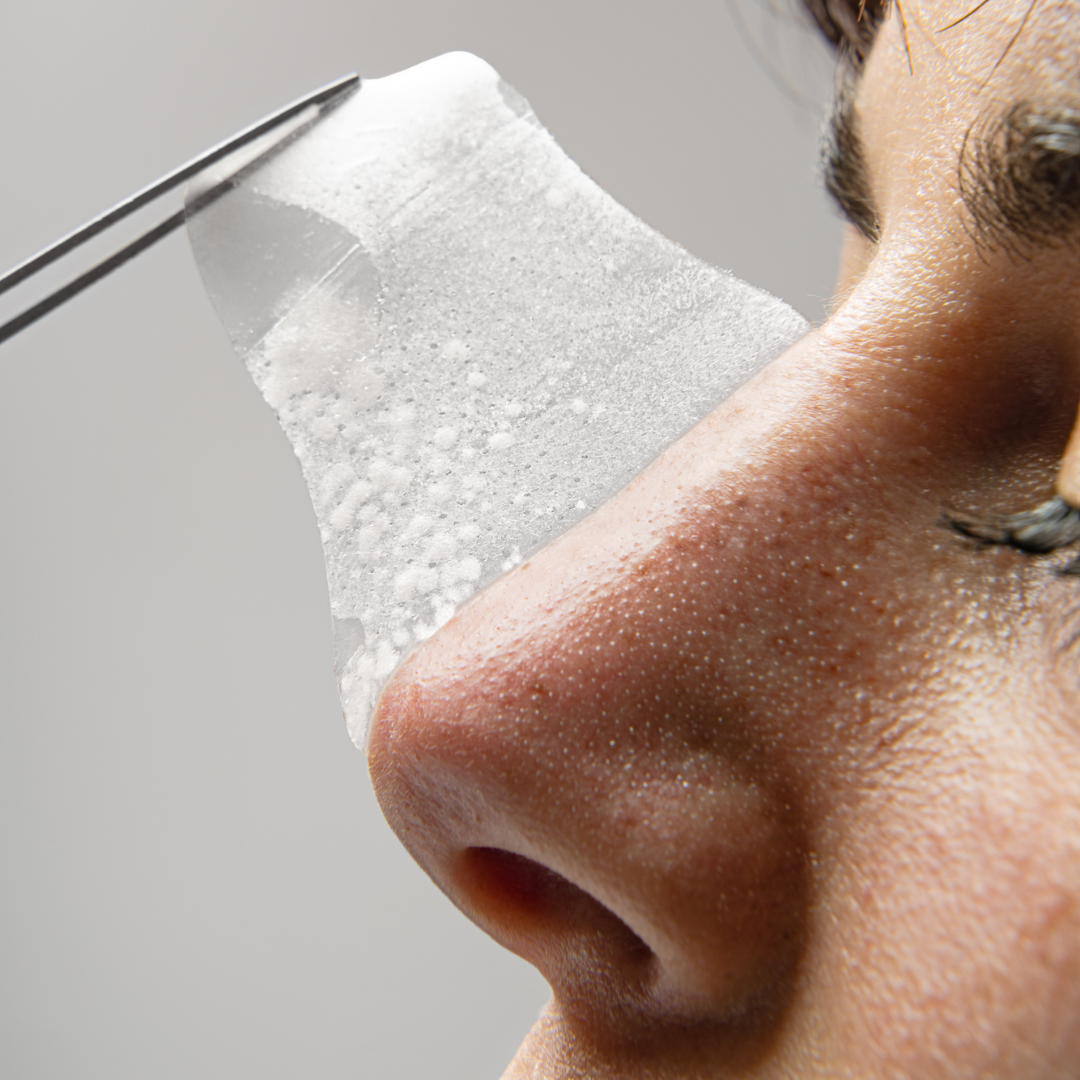 Peel OUT - Patchs nez points noirs hydrocolloïde