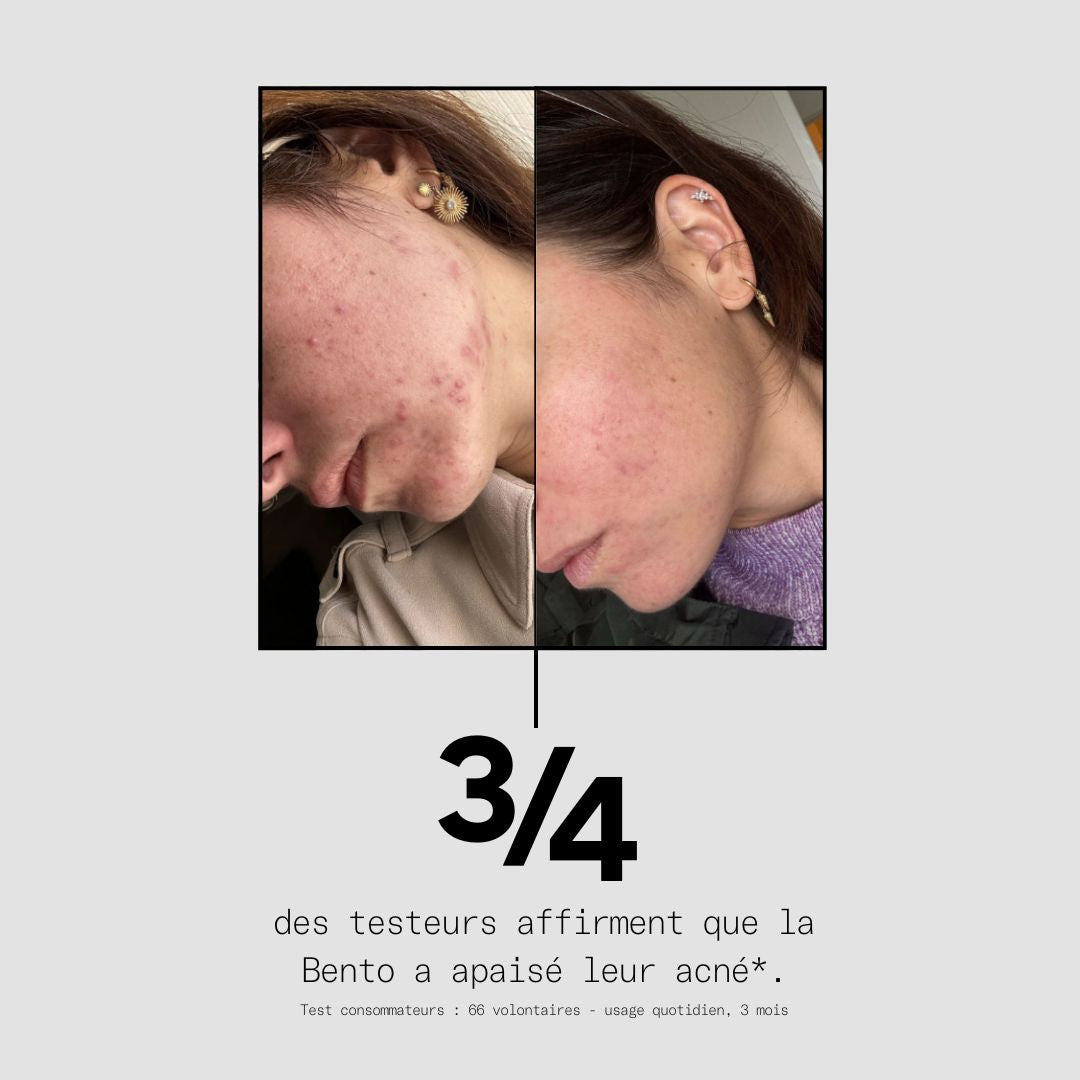 La solution complète pour tes boutons - La Bento