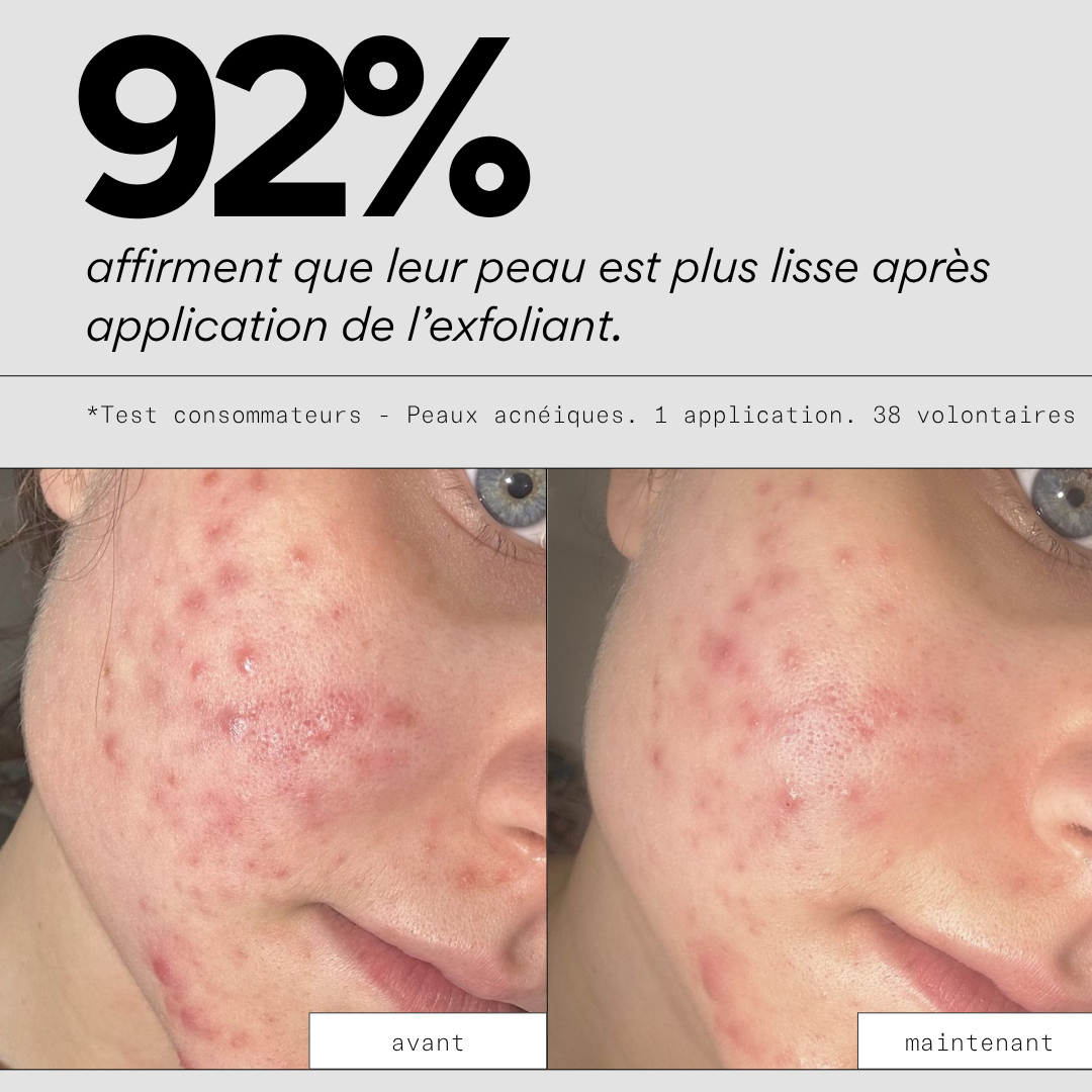 Peel OUT - Masque exfoliant