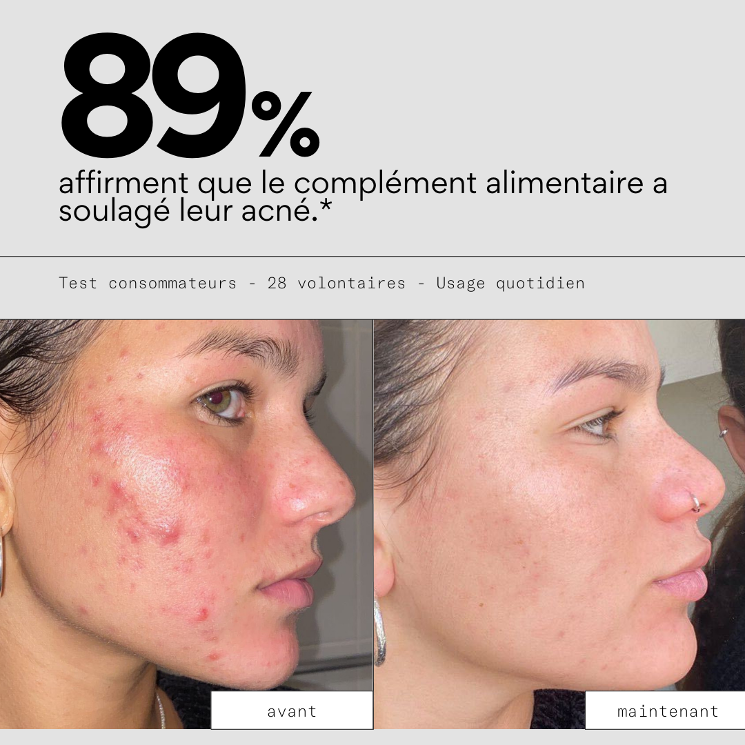 Routine IN - Cure 3 mois compléments alimentaires anti-acné