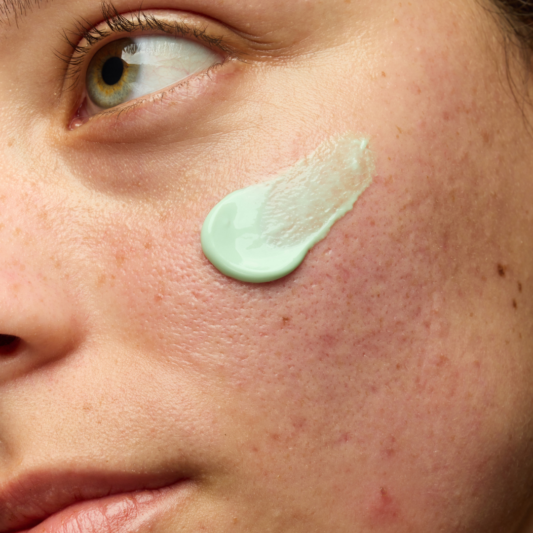 Comment choisir sa crème solaire quand on a la peau mixte à grasse ou acnéique ?