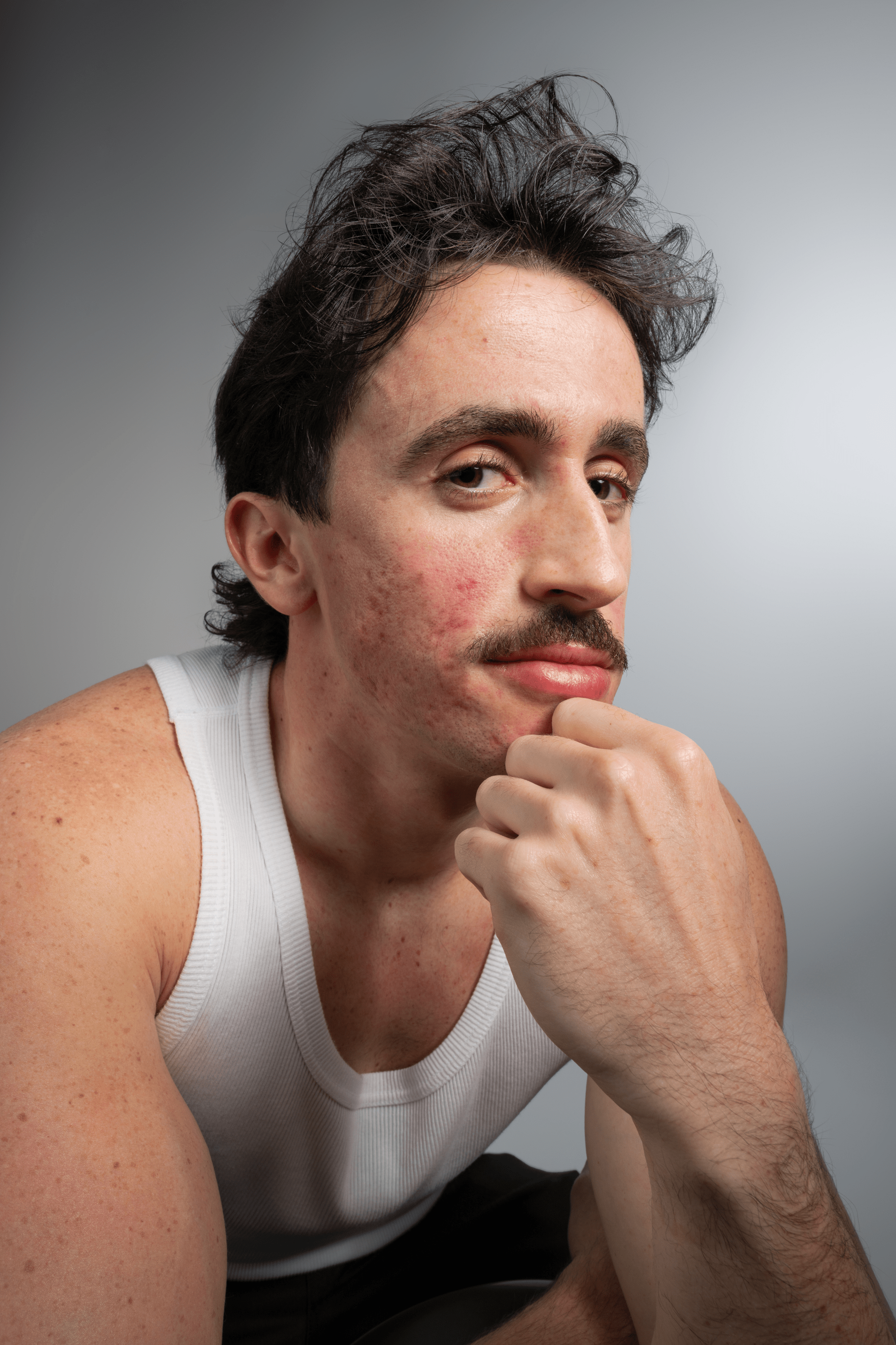 Les causes de l’acné inflammatoire chez l'adulte