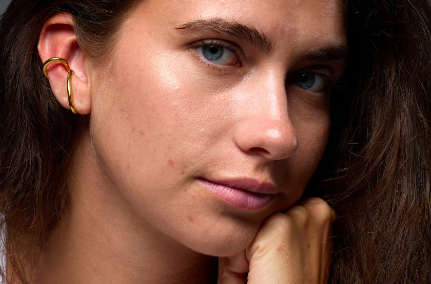 Perturbateurs endocriniens & acné : le lien dont on parle encore trop peu