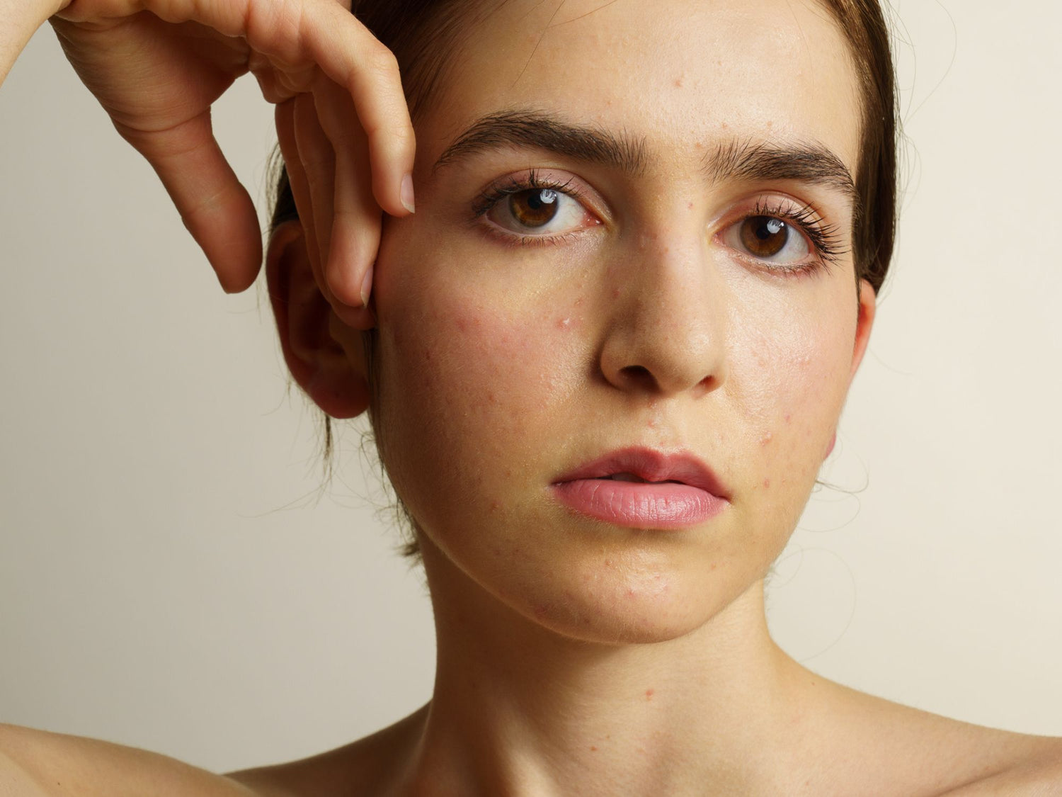 Ménopause et acné - Skin & Out