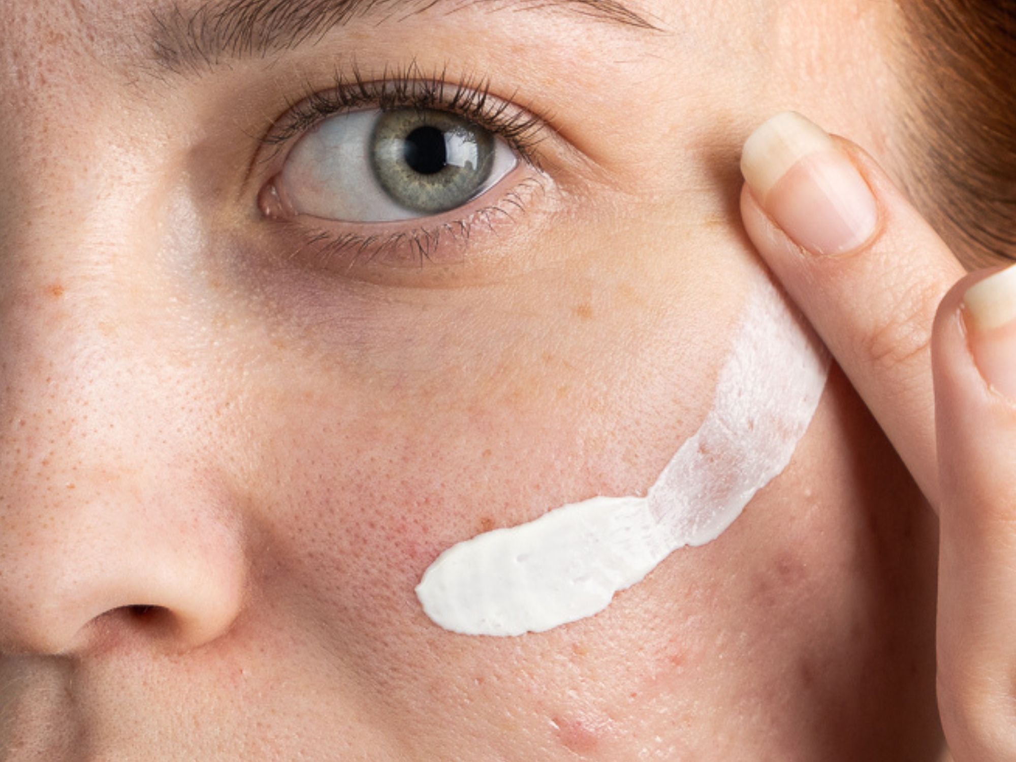 Parlons Boutons - Skin & Out