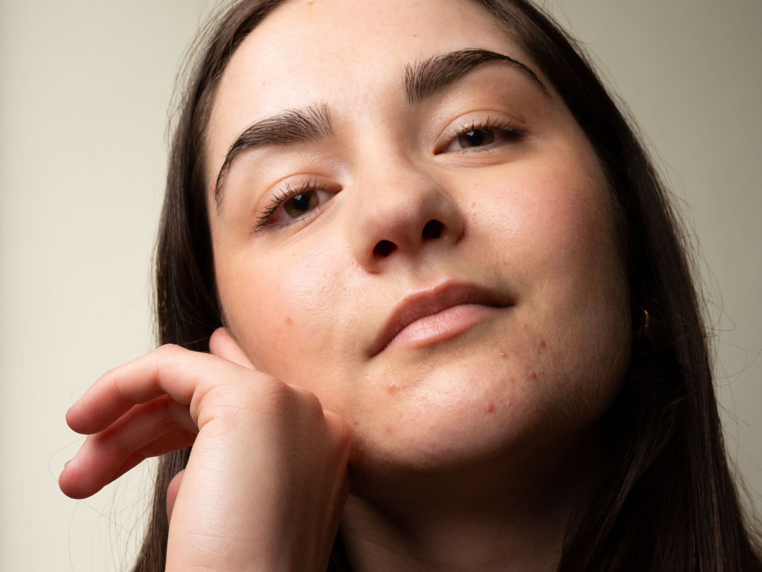 Le guide IN pour éviter l'acné liée aux règles