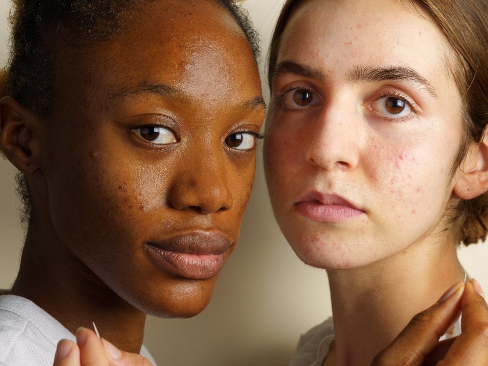 Routine Acné - Skin & Out