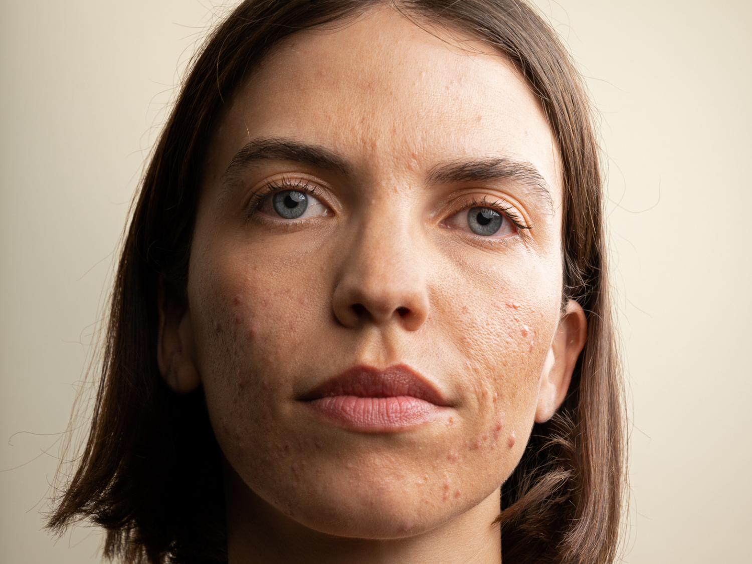 Mois du bouton - Skin & Out