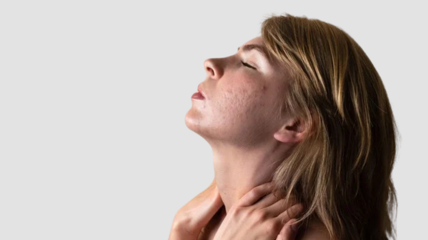 Microneedling avec Radiofréquence : Retour d’Expérience, Cicatrices d’Acné en Creux