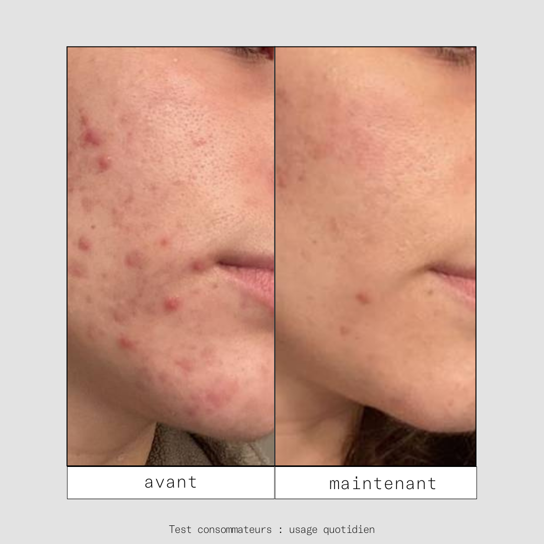 Clean OUT - Routine Double Nettoyage