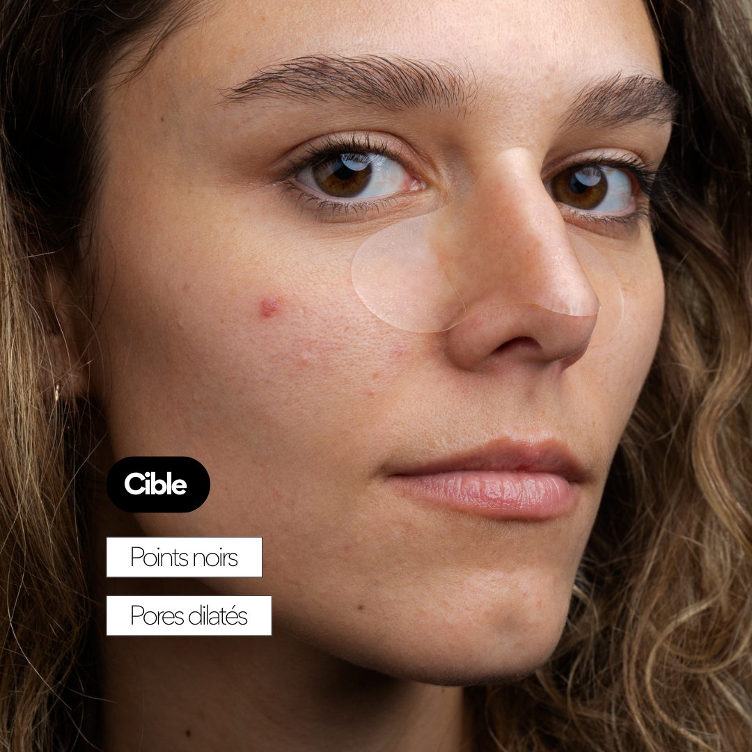 Peel OUT - Patchs nez points noirs hydrocolloïde