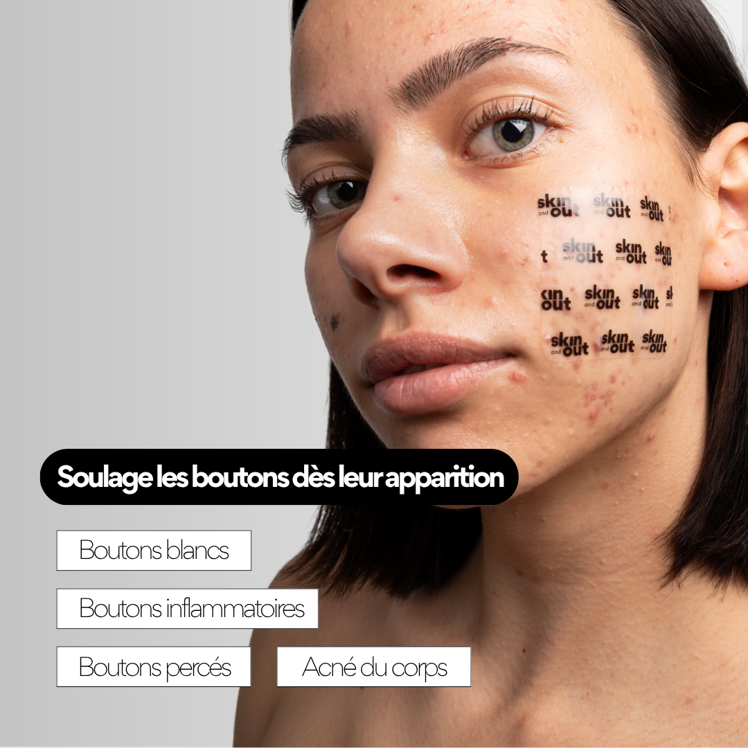 Clear OUT - Patchs XL boutons hydrocolloïde