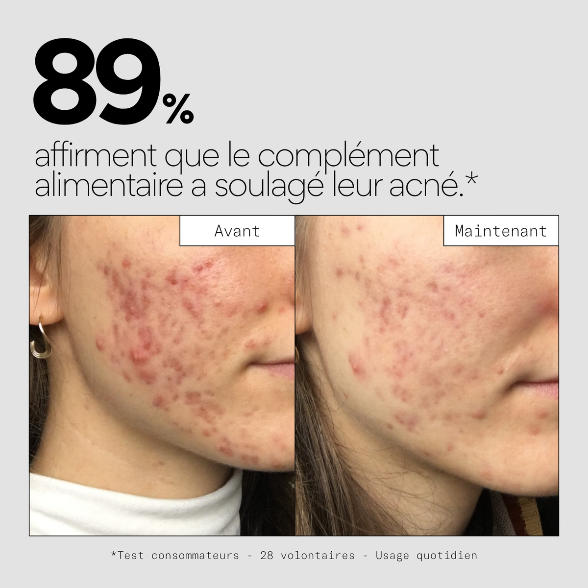 Clear IN - Complément alimentaire stop-boutons