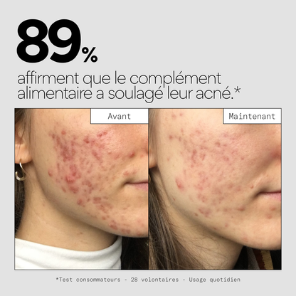 Clear IN - Complément alimentaire stop-boutons
