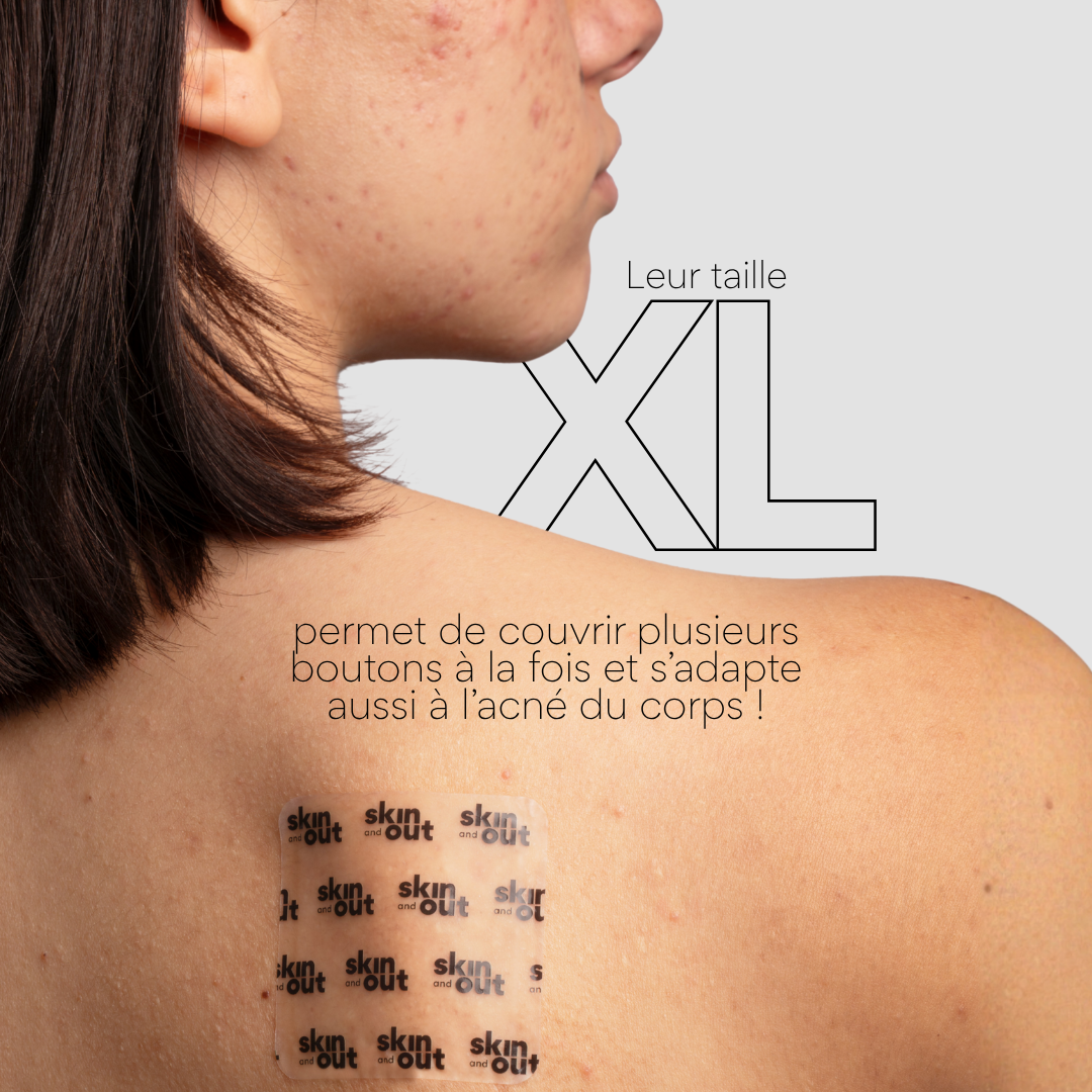 Clear OUT - Patchs XL boutons hydrocolloïde