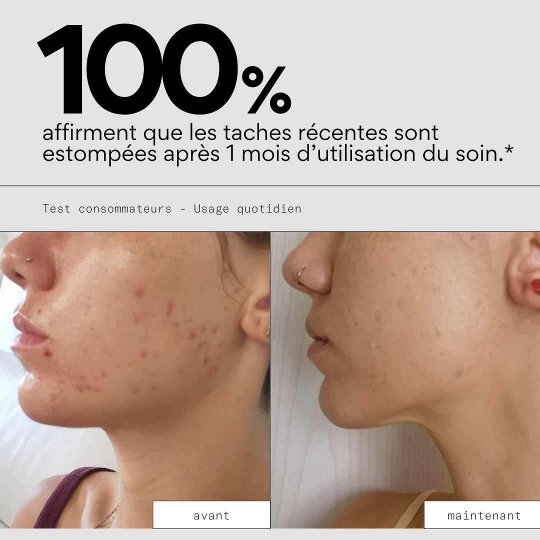 Even OUT - Soin ciblé anti-taches