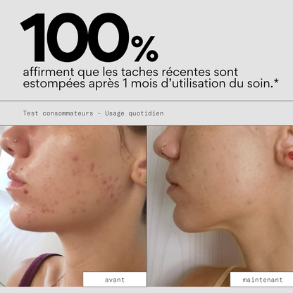 Even OUT - Soin ciblé anti-taches