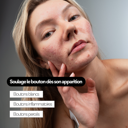 Clear OUT - Soin ciblé stop-boutons