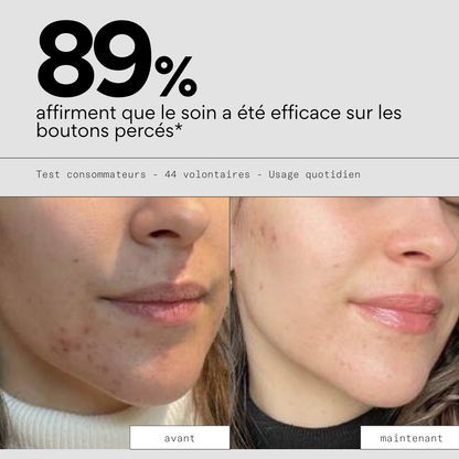 Cica OUT - Soin ciblé réparateur
