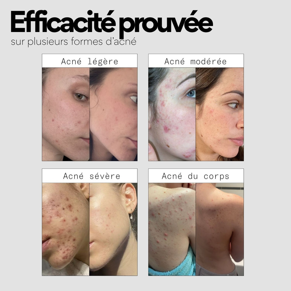La solution complète pour tes boutons - La Bento