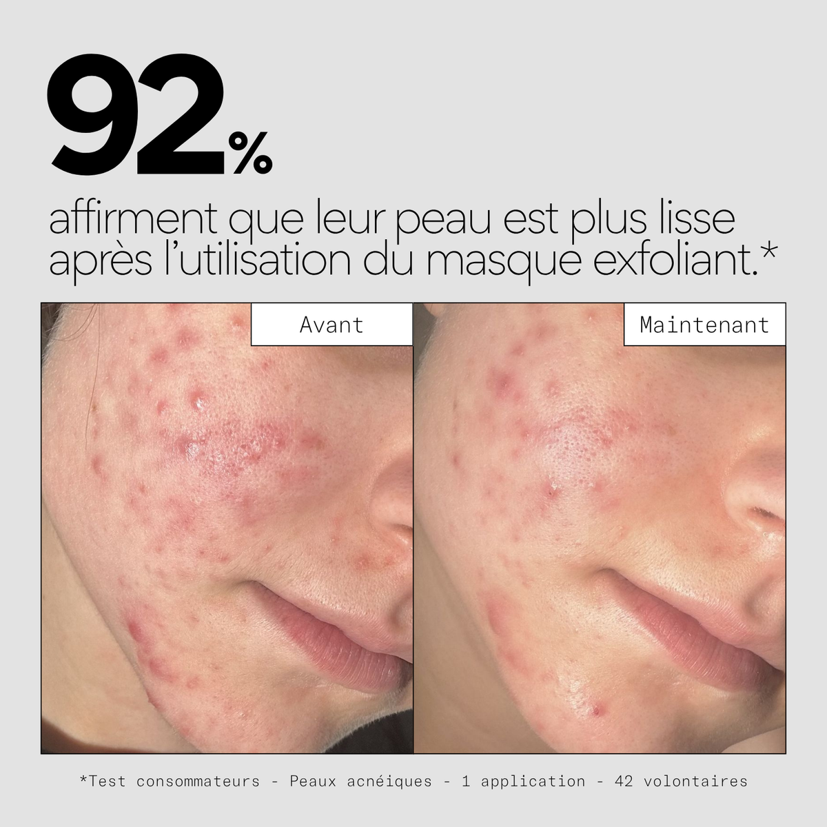 Peel OUT - Masque exfoliant