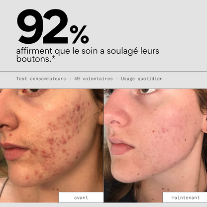 Clear OUT - Soin ciblé stop-boutons