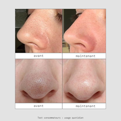 Peel OUT - Patchs Nez Purifiants