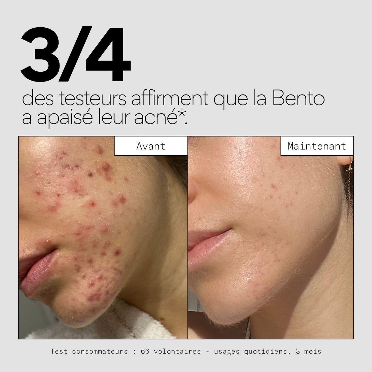 La solution complète pour tes boutons - La Bento