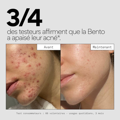 La solution complète pour tes boutons - La Bento