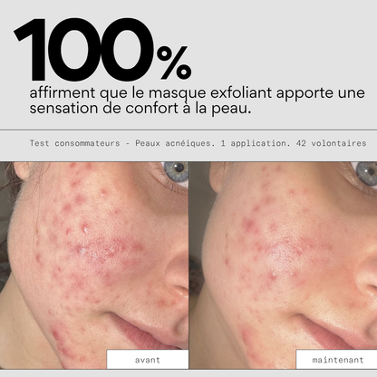 Peel OUT - Routine SOS points noirs et pores
