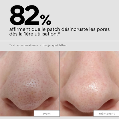 Peel OUT - Patchs Nez Purifiants x20