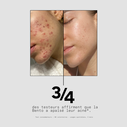 La solution complète pour tes boutons - La Bento