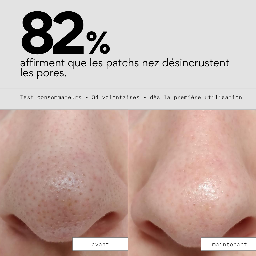 Peel OUT - Routine SOS points noirs et pores