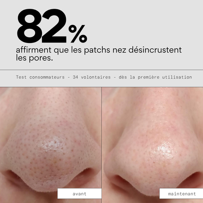Peel OUT - Routine SOS points noirs et pores