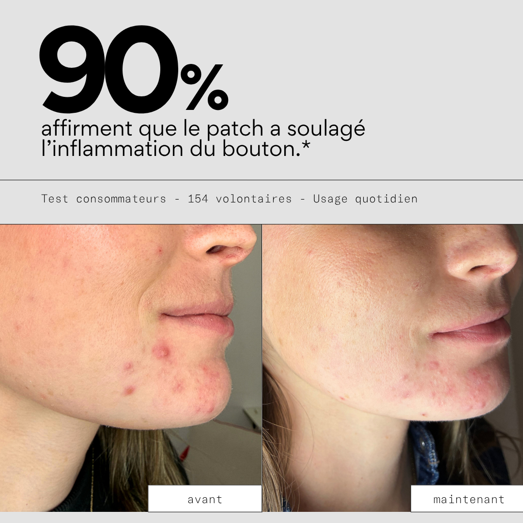 Clear OUT - Patchs XL boutons hydrocolloïde