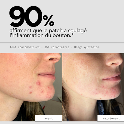 Clear OUT - Patchs XL boutons hydrocolloïde