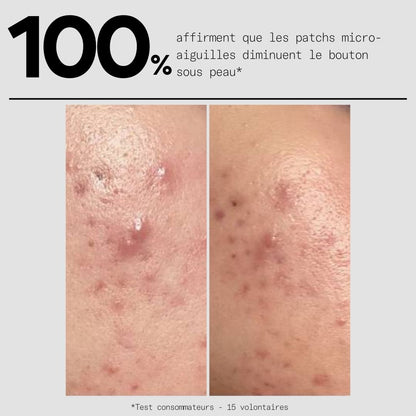 Clear OUT - Le Duo Patchs SOS Bouton