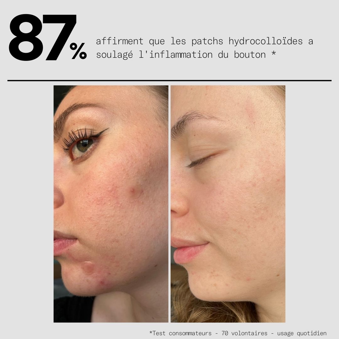 Clear OUT - Le Duo Patchs SOS Bouton