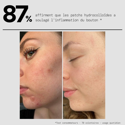 Clear OUT - Le Duo Patchs SOS Bouton