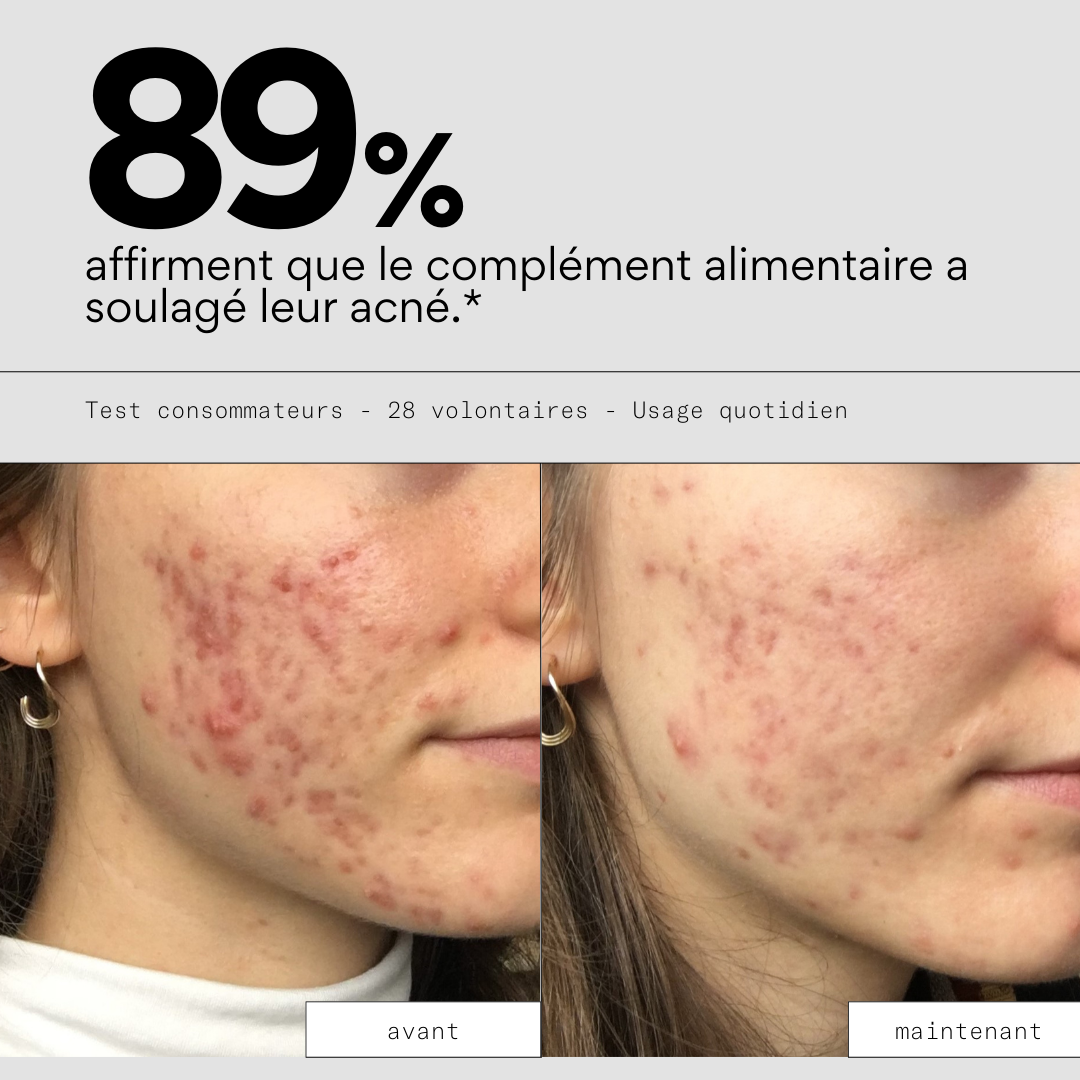 Clear IN - Complément alimentaire stop-boutons