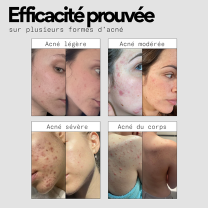 La solution complète pour tes boutons - La Bento