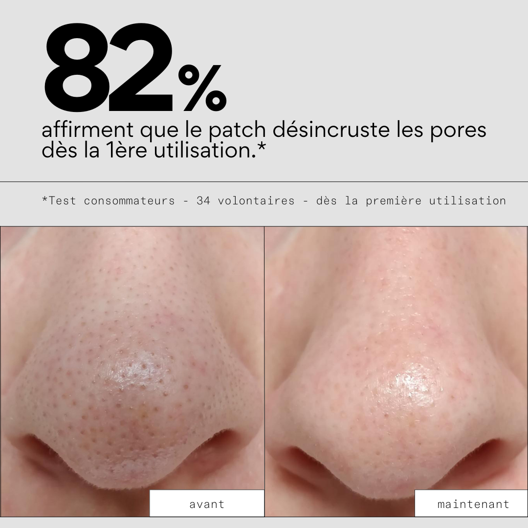 Peel OUT - Patchs nez points noirs hydrocolloïde