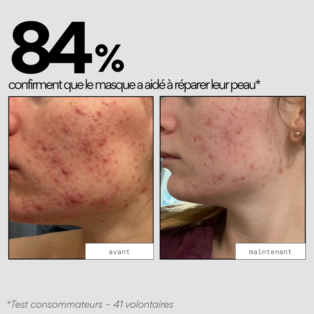 84% confirment que le masque a aidé à réparer leur peau