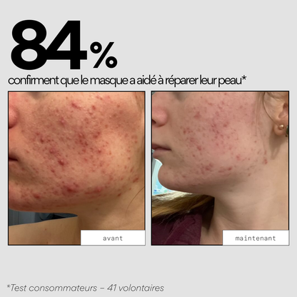 84% confirment que le masque a aidé à réparer leur peau